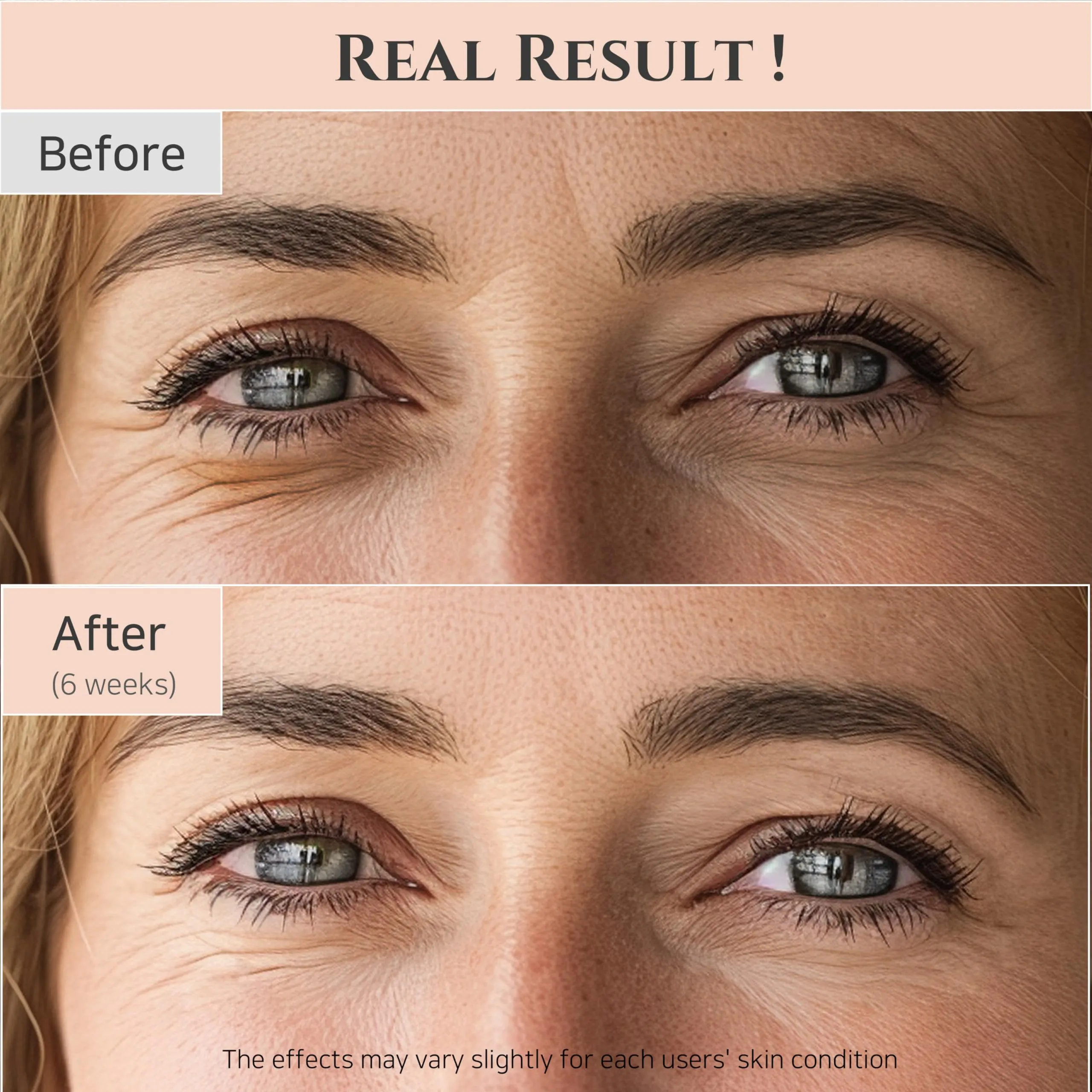 Beauty of Joseon Revive Eye Serum with Retinal Niacinamide Correction for Puffy Eye Bags Fine Lines Dark Circles Wrinkles, Korean Skin Care 30ml, 1 fl.oz 1 Fl Oz (Pack of 1)