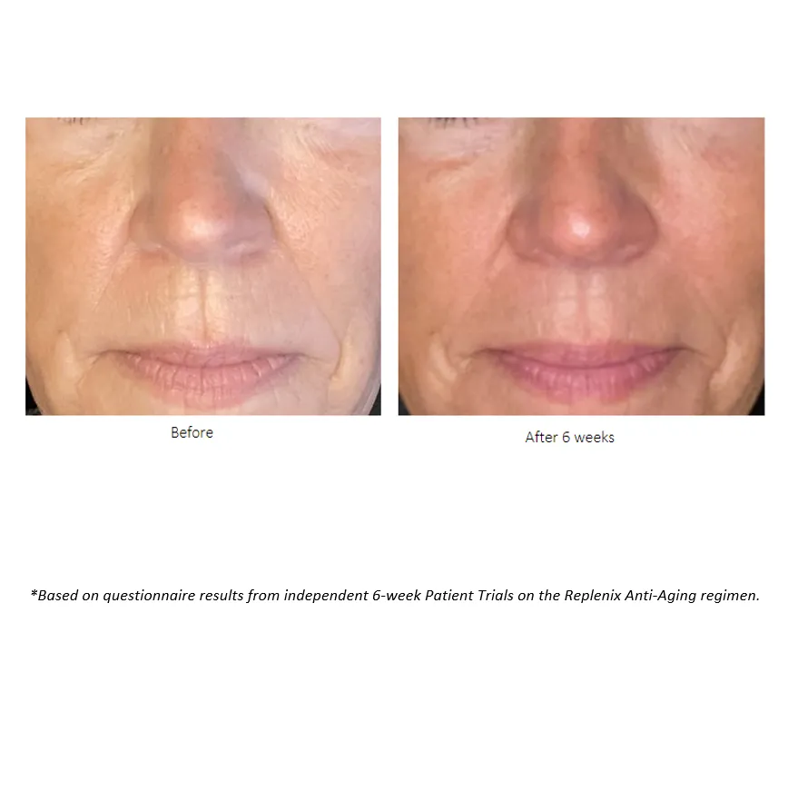 Retinol 5x Regenerate Dry Serum